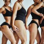 Comprendre_la_cellulite_causes_types_et_mécanisme