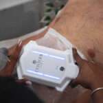 activites-du-club-cryolipolise